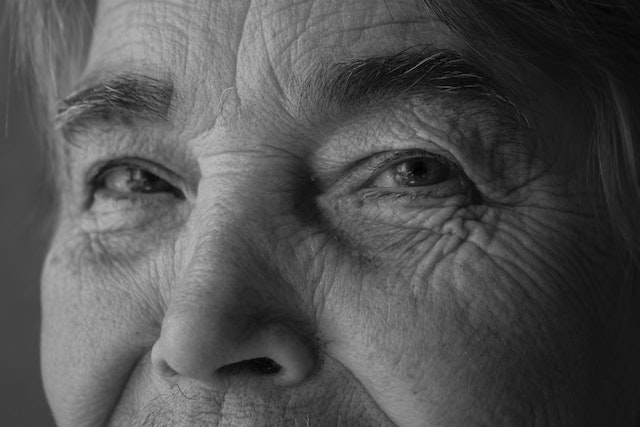 Wrinkles